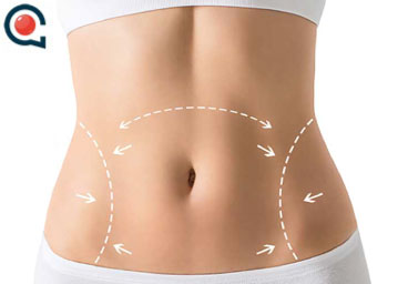 ELEVACIÓN DE MUSLOS ELEVACIÓN DE MUSLOS